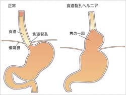 医師に連絡する時期
