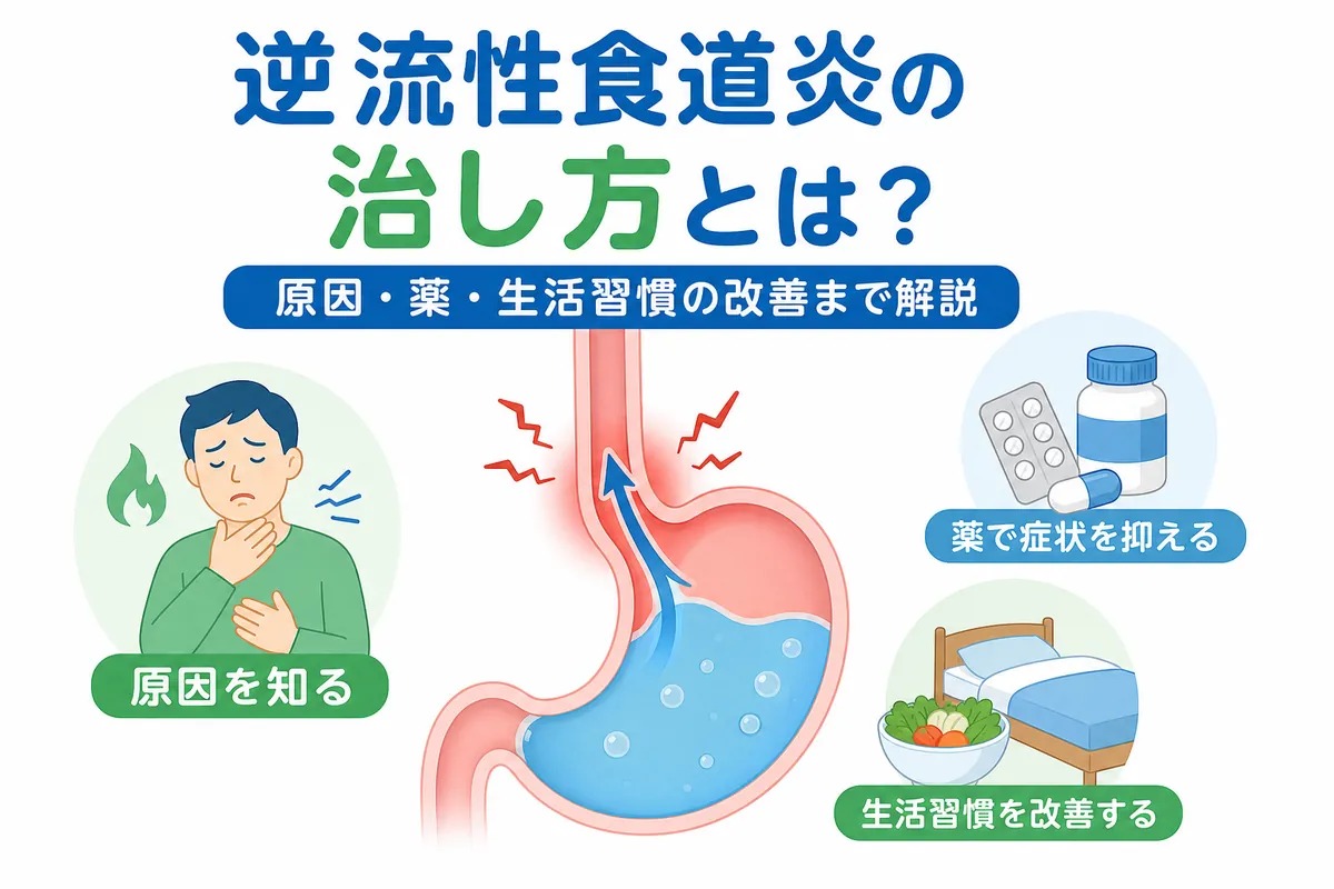 逆流 性 食道 炎 咳 治し 方