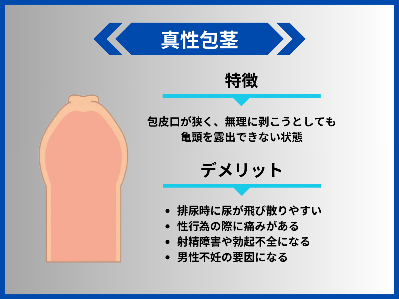 真性包茎