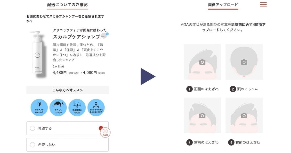 AGA治療おすすめクリニッククリニックフォアオンライン診療１６